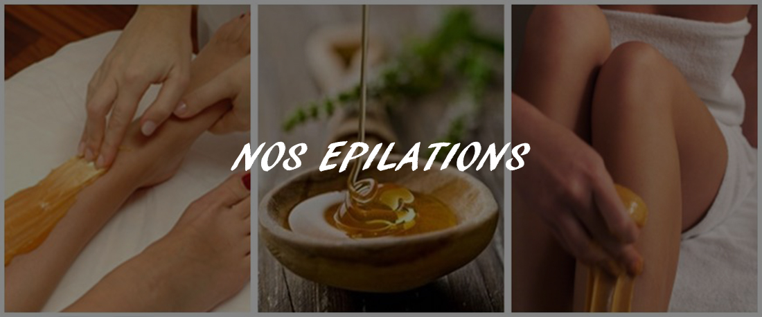 nos epilation
